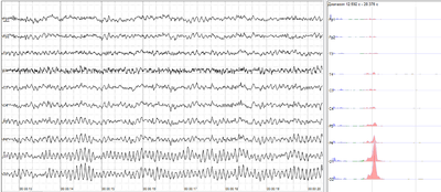 The sample of human EEG with prominent alpha-rhythm in occipital sites